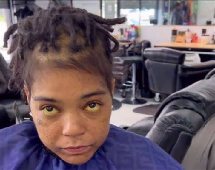 Young MA Liver Disease
